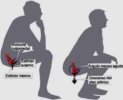 defecacion cuclillas