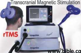 tms transcraneal magnetic stimulation