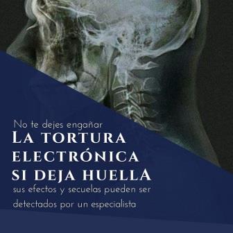 Las secuelas neurologicas de la tortura electronica