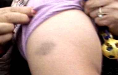 agredida matones de susana villaran 1