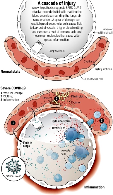 lesion vascular covid Science