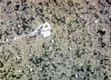 Reutlingen 70 cuerpo muy activo se calienta al microfono