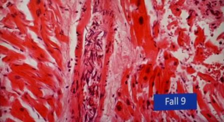 Reutlingen 25 vasos y endotelios en investigacion