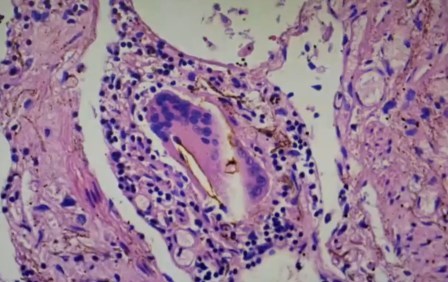 Reutlingen 53 objetos largos marrones metal disuelto en celula ampliacion