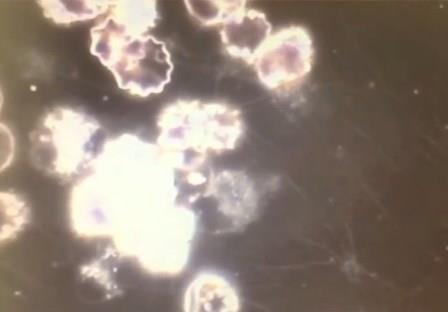 Reutlingen 65 macrofago intenta atacar cuerpo extrano