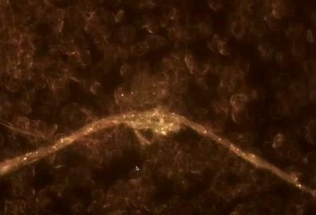 Reutlingen 66 sangre vacunado Pfizer