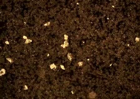 Reutlingen 67 Pfizer eritrocitos formando grumos