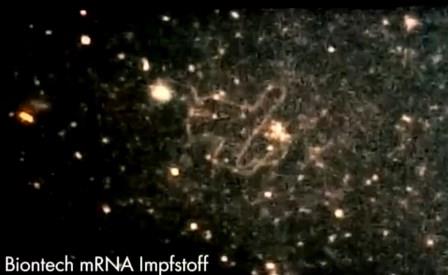 Reutlingen 70 cuerpo muy activo se calienta al microfono