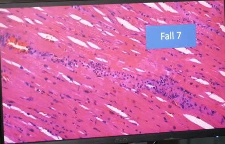 Reutlingen 9 pila de dinero corazon