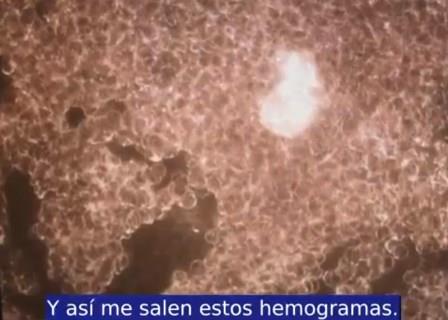 estructuras sangre covid 8