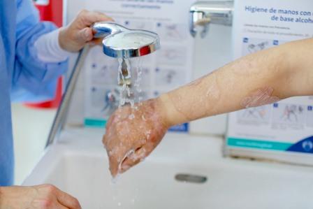 quemadura agua