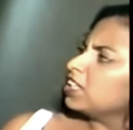 patricia chirinos antes operaciones