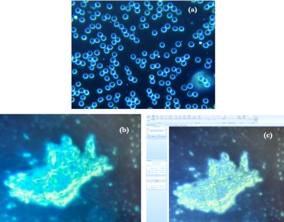 sangre antes despues ARNm covid