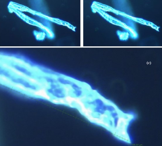 sangre tras ARNm covid rara estructura