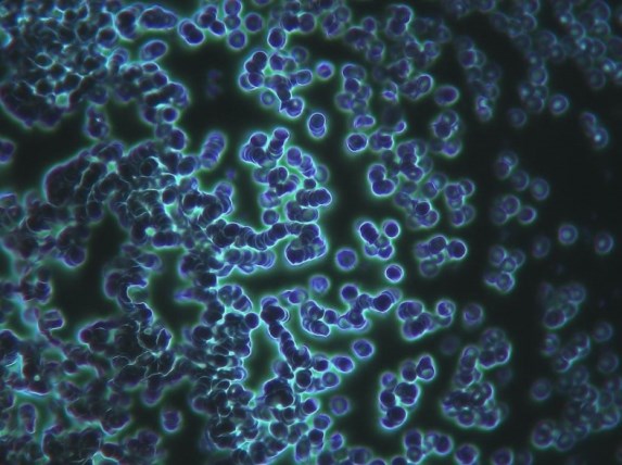 sangre tras ARNm globulos rojos agrupados en cadenas