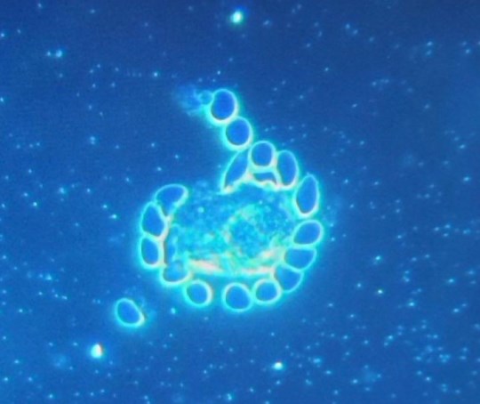 sangre tras ARNm globulos rojos rodeando a posible particula de grafeno