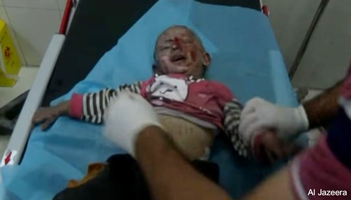 nino herido Gaza oct 2023