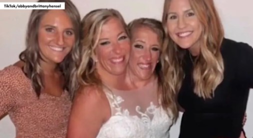 Abby Hensel siamesa 2 boda mar 2024