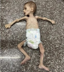 bebe muerto hambre Gaza jun 2024 Fayez Abu Ataya