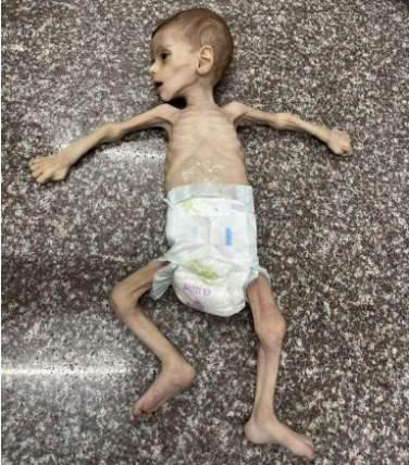 bebe muerto hambre Gaza jun 2024 Fayez Abu Ataya