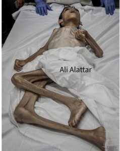 nino muerto hambre Gaza jun 2024